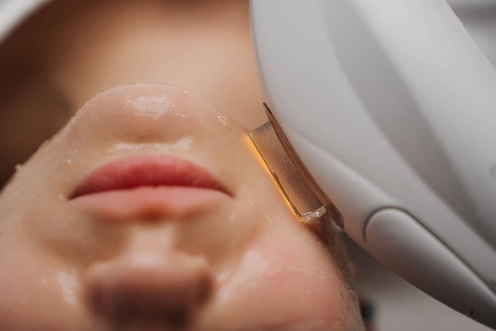 Closeup of a woman's face while she gets IPL Treatment